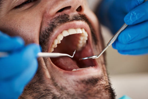 Best Dentist for Tooth Abscess  in Paris, KY